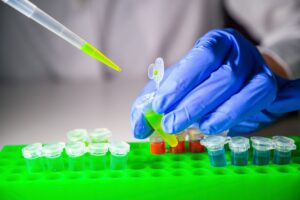 Scientist taking out green solution in eppendorf tube and pipette for biomedical research with tube rack on a white bench.